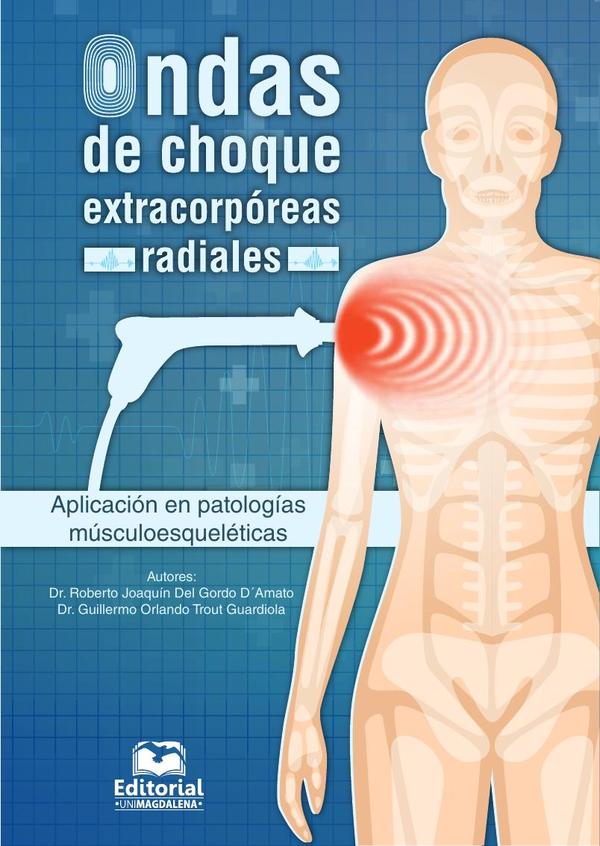ONDAS DE CHOQUE EXTRACORPOREAS RADIALES